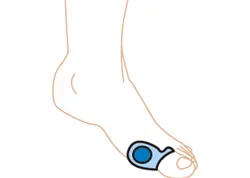Silipos Silopad Gel Bunion Protecion Small - 5/Pack # 10085