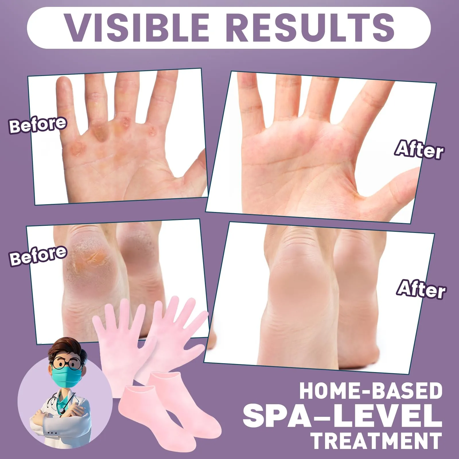 TEAWOO 2 Pairs Silicone Socks Gloves Set for Dry Cracked Feet Hands, Silicone Moisturizing Socks for Women, Hand Foot Care, Spa Gel Socks Gloves After Pedicure (Socks Fits Up to Size 10)